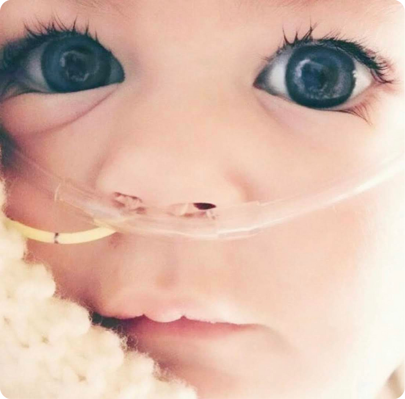 Close-up of a baby's face with a air tube